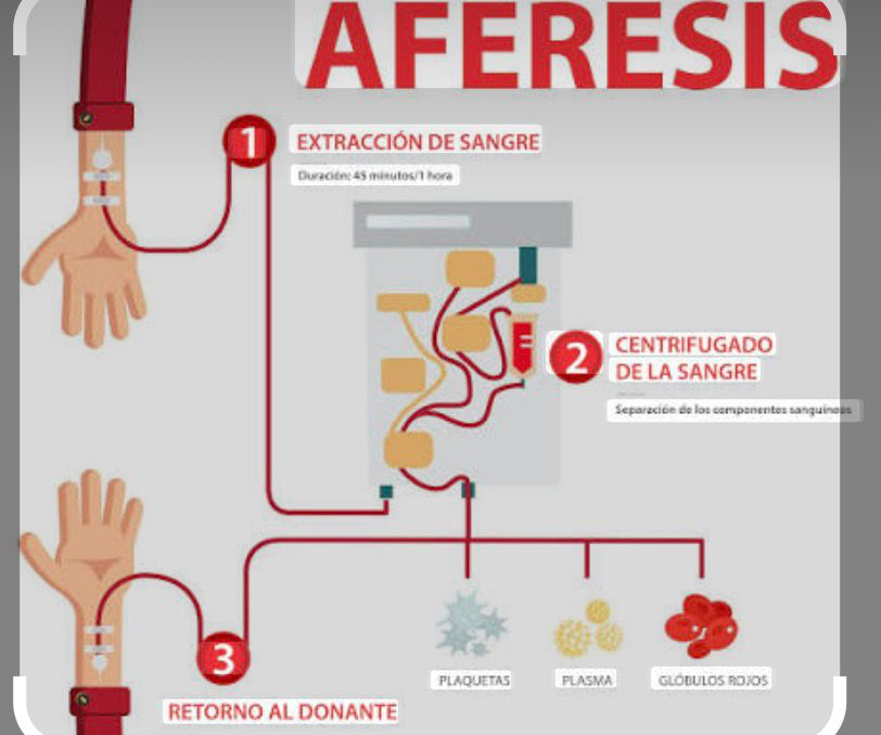 Aferisis plaquetarios